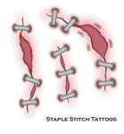 Tattoo Staple Stitch Fx